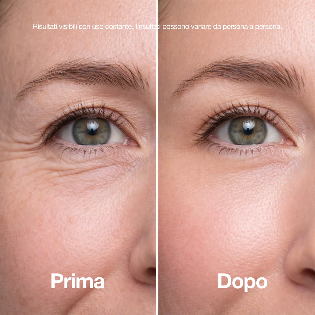 Stick Lifting al Collagene Rosa e PDRN